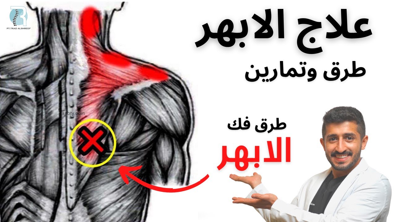 طرق فك الابهر وعلاج الابهر، طرق جديدة لفك العقد العضلية نقاط الزناد trigger points