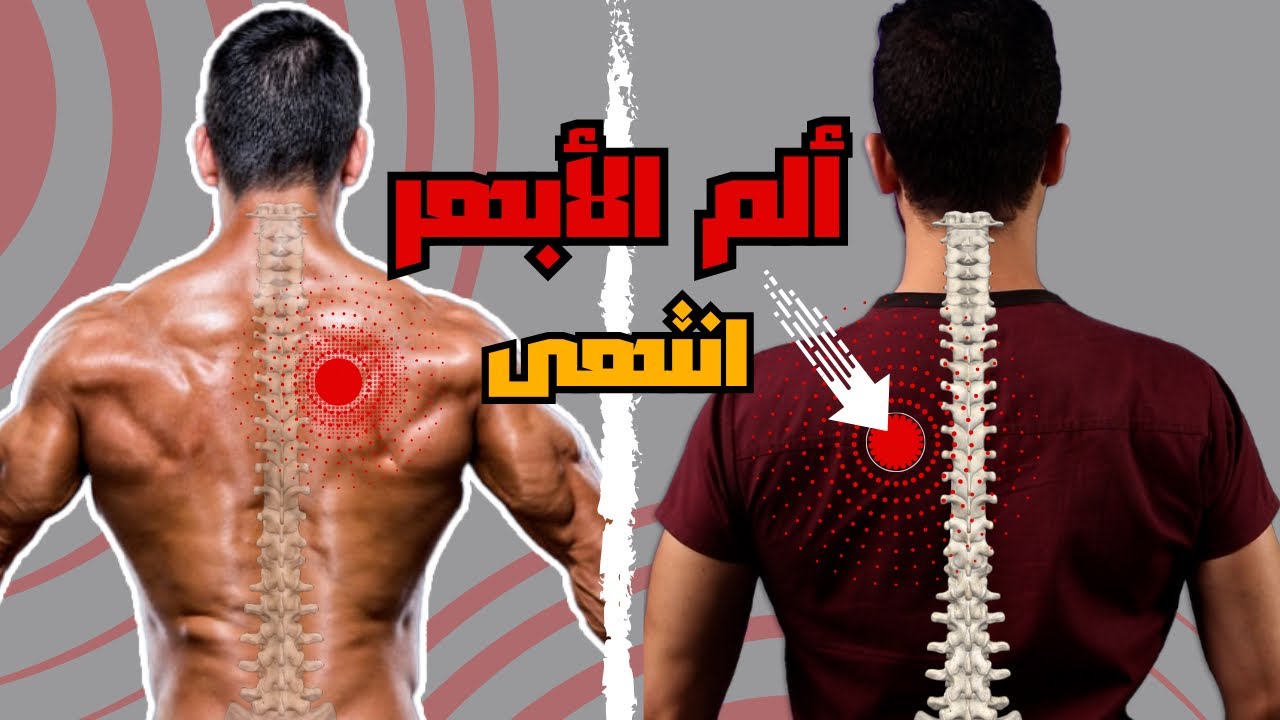 السبب الخفي لألم الأبهر | عالج ألم منتصف الظهر الآن وللأبد 👌
